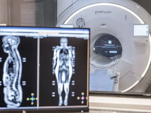 This photo provided by Prenuvo in July 2024 shows an MRI scanner. Magnetic resonance imaging uses magnetic fields to produce detailed images of organs, bones and other structures inside the body. Unlike many other types of scans, MRIs don't use radiation. (Prenuvo via AP)