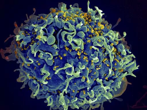 This electron microscope image made available by the U.S. National Institutes of Health shows a human T cell, in blue, under attack by HIV, in yellow, the virus that causes AIDS. Hard-won progress against HIV has stalled, putting millions of lives at risk, according to an alarming report Wednesday, July 27, 2022 on how the collision with the COVID-19 pandemic and other global crises is jeopardizing efforts to end AIDS. The report from UNAIDS is being released ahead of the start of the Internatio